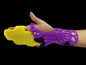 startup desenvolve imobilizador ortopédico