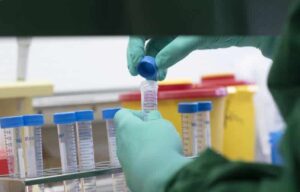 Ceará pode se tornar estado a bater pico de Covid-19 no Brasil 06-04-2020